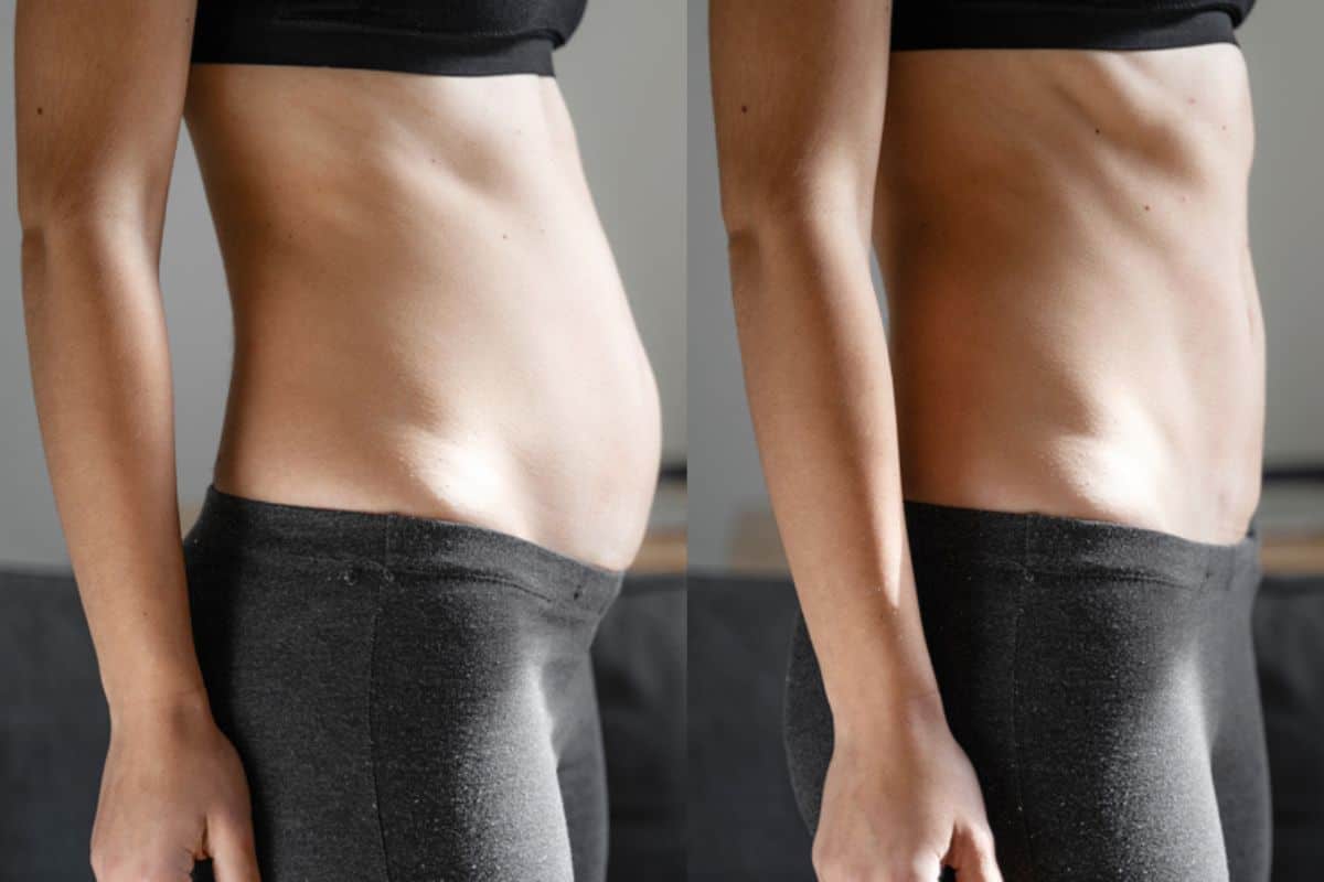 Post-Pregnancy: What Happens to Your Abdominal Muscles After Birth Kings Langley