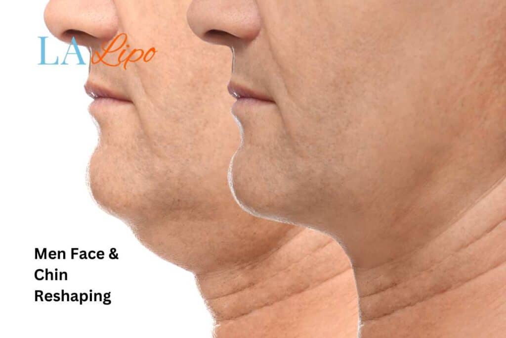 men-chin-face