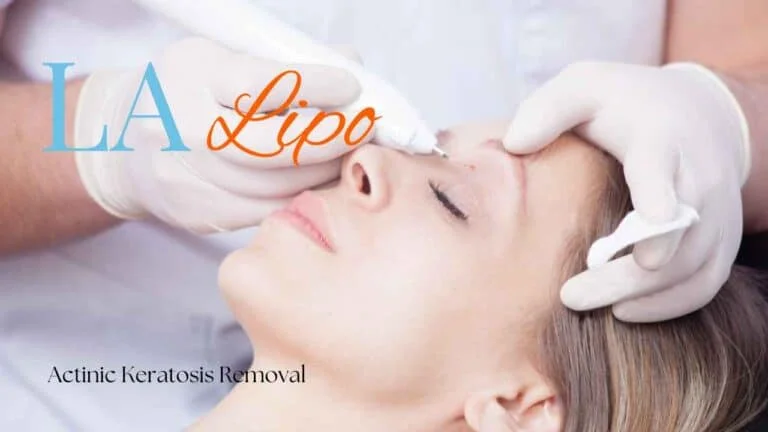 Woman receiving Actinic Keratosis Removal Treatment Kings Langley