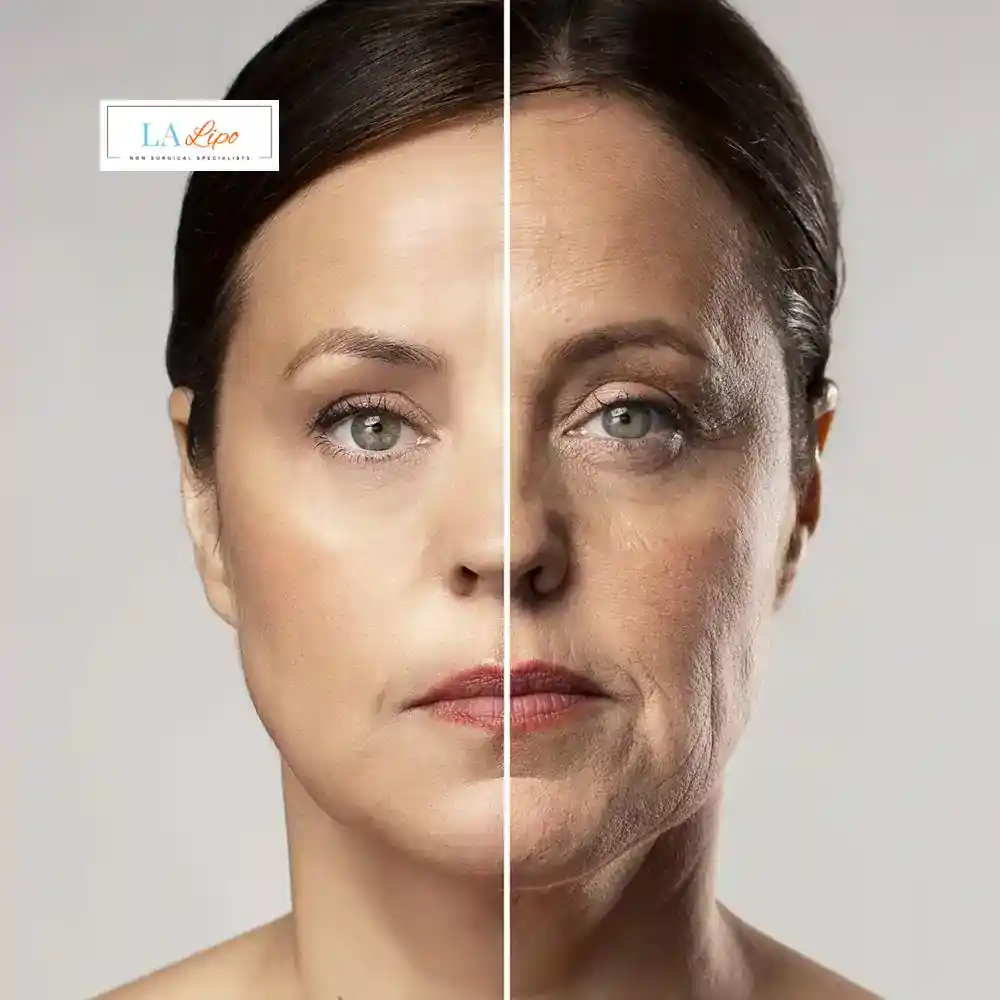 How Can You Tell If Non-Surgical Skin Tightening Is Right for You Kings Langley?