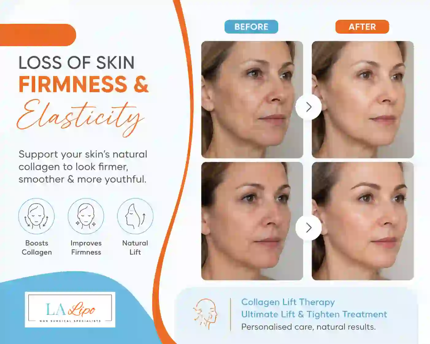 Sign #7: Loss of Skin Firmness and Elasticity Kings Langley
