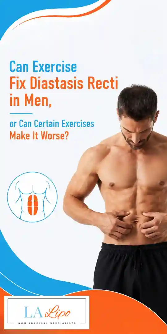 Can Exercise Fix Diastasis Recti in Men, or Can Certain Exercises Make It Worse Kings Langley?
